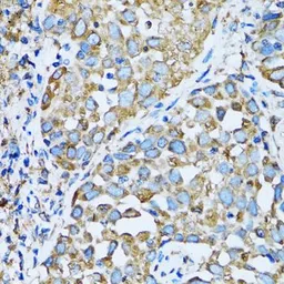 Anti-OGDH antibody used in IHC (Paraffin sections) (IHC-P). GTX33374