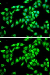 Anti-PCMT1 antibody used in Immunocytochemistry/ Immunofluorescence (ICC/IF). GTX33392
