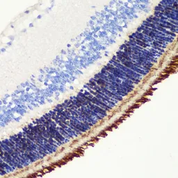 Anti-PDE6B antibody used in IHC (Paraffin sections) (IHC-P). GTX33395