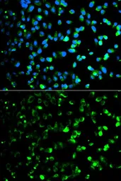 Anti-Thymidine Phosphorylase antibody used in Immunocytochemistry/ Immunofluorescence (ICC/IF). GTX33396