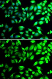 Anti-PDIA6 antibody used in Immunocytochemistry/ Immunofluorescence (ICC/IF). GTX33397