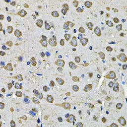 Anti-PDIA6 antibody used in IHC (Paraffin sections) (IHC-P). GTX33397