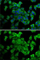 Anti-Periplakin antibody used in Immunocytochemistry/ Immunofluorescence (ICC/IF). GTX33403