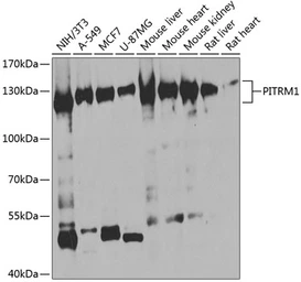 Anti-PITRM1 antibody used in Western Blot (WB). GTX33412