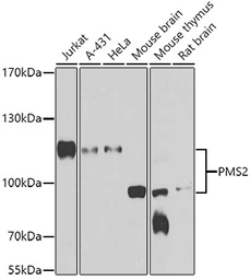 Anti-PMS2 antibody used in Western Blot (WB). GTX33418