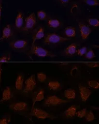 Anti-PP2A beta antibody used in Immunocytochemistry/ Immunofluorescence (ICC/IF). GTX33421