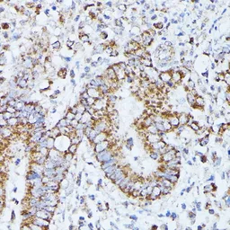 Anti-PP2A beta antibody used in IHC (Paraffin sections) (IHC-P). GTX33421