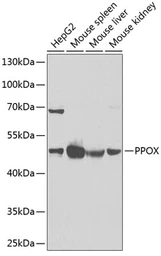 Anti-PPOX antibody used in Western Blot (WB). GTX33424