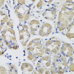 Anti-PSPH antibody used in IHC (Paraffin sections) (IHC-P). GTX33442