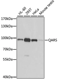 Anti-QARS antibody used in Western Blot (WB). GTX33449
