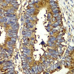 Anti-QARS antibody used in IHC (Paraffin sections) (IHC-P). GTX33449