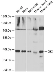 Anti-QKI antibody used in Western Blot (WB). GTX33450