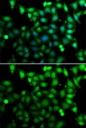 Anti-RAE1 antibody used in Immunocytochemistry/ Immunofluorescence (ICC/IF). GTX33456
