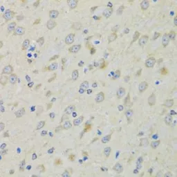 Anti-RAE1 antibody used in IHC (Paraffin sections) (IHC-P). GTX33456