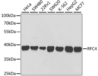 Anti-RFC4 antibody used in Western Blot (WB). GTX33465