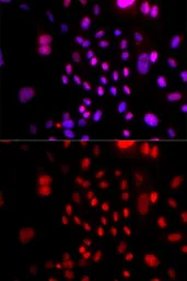 Anti-RFC4 antibody used in Immunocytochemistry/ Immunofluorescence (ICC/IF). GTX33465