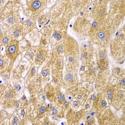 Anti-Ribophorin I antibody used in IHC (Paraffin sections) (IHC-P). GTX33466