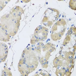 Anti-RPLP1 antibody used in IHC (Paraffin sections) (IHC-P). GTX33474