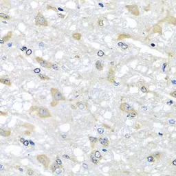 Anti-RPLP1 antibody used in IHC (Paraffin sections) (IHC-P). GTX33474