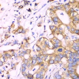 Anti-RPS3A antibody used in IHC (Paraffin sections) (IHC-P). GTX33478