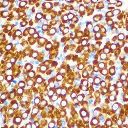Anti-SCO2 antibody used in IHC (Paraffin sections) (IHC-P). GTX33486