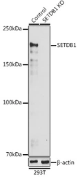 Anti-SETDB1 antibody used in Western Blot (WB). GTX33492