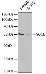 Anti-SGCE antibody used in Western Blot (WB). GTX33494