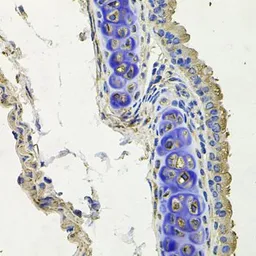 Anti-SKP1 antibody used in IHC (Paraffin sections) (IHC-P). GTX33502