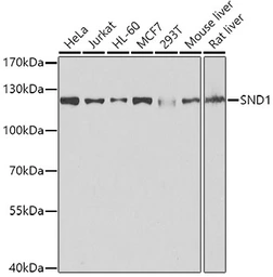 Anti-SND1 antibody used in Western Blot (WB). GTX33508