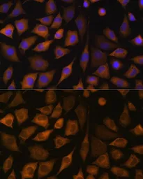 Anti-SND1 antibody used in Immunocytochemistry/ Immunofluorescence (ICC/IF). GTX33508