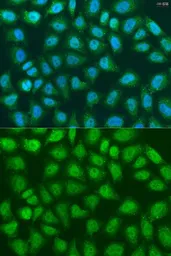 Anti-SOCS4 antibody used in Immunocytochemistry/ Immunofluorescence (ICC/IF). GTX33513