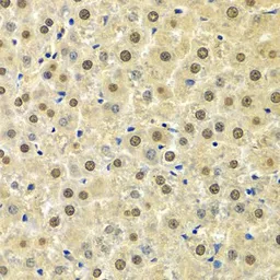 Anti-SPHK1 antibody used in IHC (Paraffin sections) (IHC-P). GTX33516