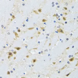 Anti-TCP1 delta antibody used in IHC (Paraffin sections) (IHC-P). GTX33536