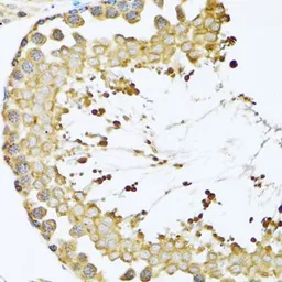 Anti-TCP1 delta antibody used in IHC (Paraffin sections) (IHC-P). GTX33536