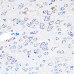 Anti-TFEB antibody used in IHC (Paraffin sections) (IHC-P). GTX33541