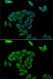 Anti-TGM3 antibody used in Immunocytochemistry/ Immunofluorescence (ICC/IF). GTX33543