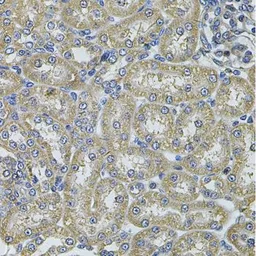 Anti-TID1 antibody used in IHC (Paraffin sections) (IHC-P). GTX33546