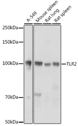 Anti-TLR2 antibody used in Western Blot (WB). GTX33547