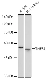 Anti-TNF Receptor I antibody used in Western Blot (WB). GTX33550