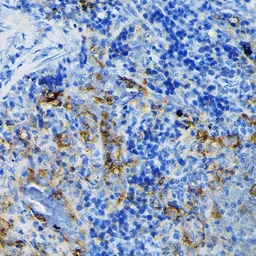 Anti-TNF Receptor I antibody used in IHC (Paraffin sections) (IHC-P). GTX33550