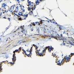 Anti-TNF Receptor I antibody used in IHC (Paraffin sections) (IHC-P). GTX33550