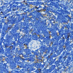 Anti-TNF Receptor I antibody used in IHC (Paraffin sections) (IHC-P). GTX33550