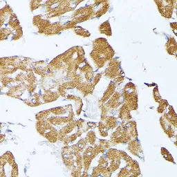 Anti-TRAP1 antibody used in IHC (Paraffin sections) (IHC-P). GTX33558