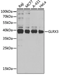Anti-TXNL2 antibody used in Western Blot (WB). GTX33564