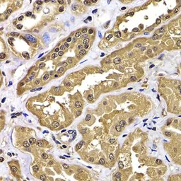 Anti-WBSCR22 antibody used in IHC (Paraffin sections) (IHC-P). GTX33582