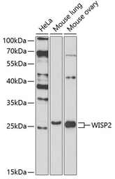 Anti-WISP2 antibody used in Western Blot (WB). GTX33585