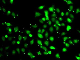 Anti-XIAP antibody used in Immunocytochemistry/ Immunofluorescence (ICC/IF). GTX33586