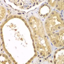 Anti-XIAP antibody used in IHC (Paraffin sections) (IHC-P). GTX33586
