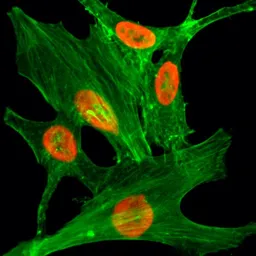 Anti-Histone H2A.Z (Acetyl Lys4) antibody [RM221] used in Immunocytochemistry/ Immunofluorescence (ICC/IF). GTX33591