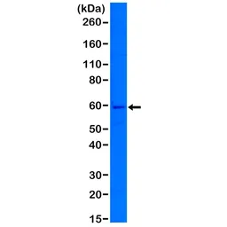 Anti-Cytokeratin 5 antibody [RM226] used in Western Blot (WB). GTX33612
